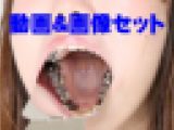 さきちゃんの歯　壮絶銀歯娘 ★★動画＆特典画像付き★★