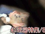 【再販】【検診/心電図】過去作ダイジェスト公開!! 美女の心電図シーン詰め合わせ！